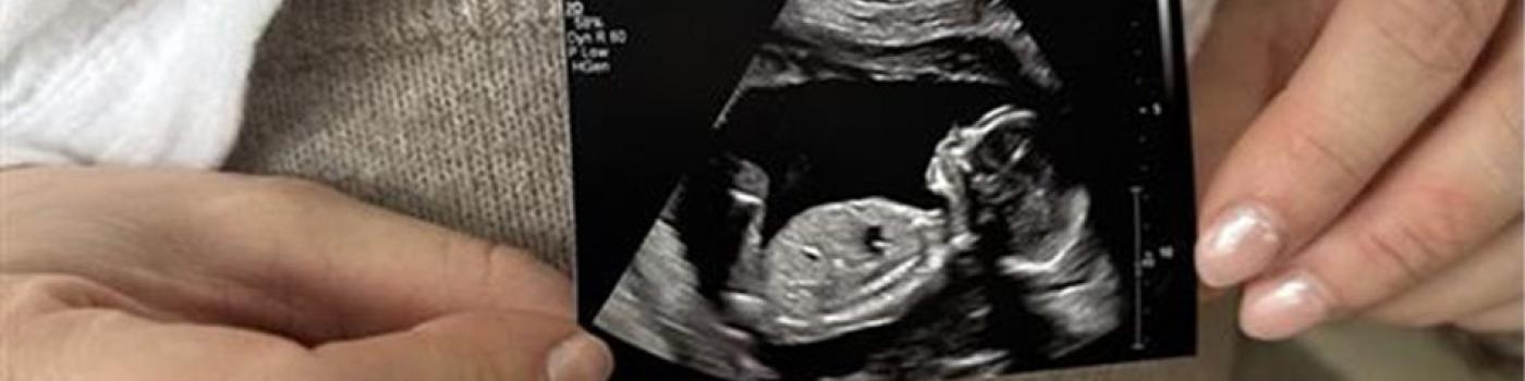 Hands holding an ultrasound image of a fetus.