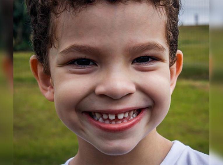 Child smiling with his teeth showing.